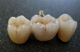 Image result for Victorian Teeth Jewelry