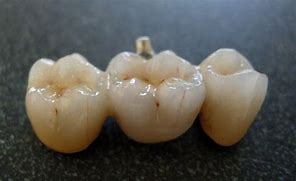 Image result for Jewelry for Teeth