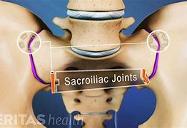 Image result for Sacroiliac Joint X-ray Normal