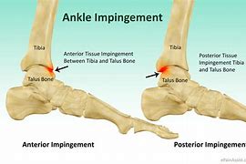 Image result for Ankle