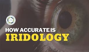 Image result for The Eye Iridology Reading Chart