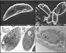 Image result for Toxoplasma Gondii Parasite