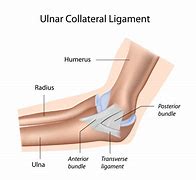 Image result for Ulnar Collateral Ligament Elbow