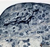 Image result for Leishmania