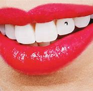 Image result for Dental Jewelry Teeth