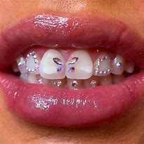 Image result for Dental Jewelry Teeth