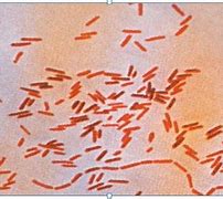 Image result for Proteobacteria