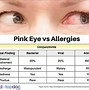 Image result for Pink Eye or Allergies