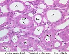 Image result for Renal Brush Border