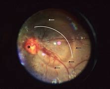 Image result for Frontal Eye Field Pathway