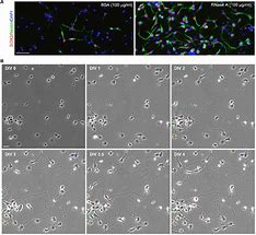 Image result for Red Neuronal Artificial