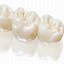 Image result for Zirconia Crown