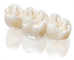 Image result for Zirconia Crown