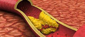 Image result for Blood Lipids