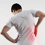 Image result for Lower Back Pain Sacroiliac Joint