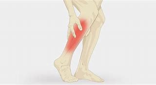 Image result for Muscle Cramps