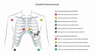 Image result for 12 Lead EKG Clip Art