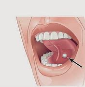 Image result for Sublingual Administration