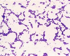 Image result for 3 Types of Bacteria