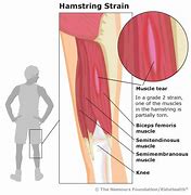 Image result for Hamstring Muscle Pain