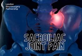 Image result for Lower Back Pain Sacroiliac Joint