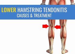 Image result for Tendinopathy Hamstring Knee