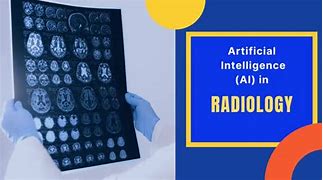 Image result for Artificial Intelligence in Radiology