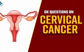 Image result for Stage 4 Cervical Cancer