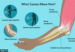 Image result for Elbow