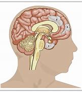 Image result for Westoid Brain Meme