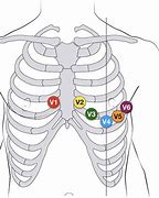 Image result for 12 Lead EKG Clip Art