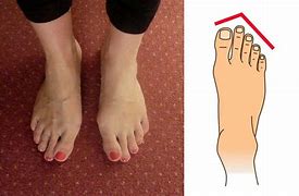 Image result for Normal X-ray Kaki Manusia