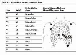 Image result for ECG Strip 12 Lead Template