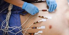 Image result for EKG Technician School