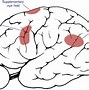 Image result for Conjugate Eye Movement