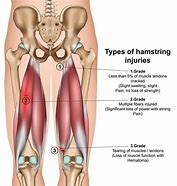 Image result for Tendinopathy Hamstring Knee