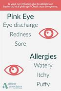 Image result for Pink Eye or Allergies