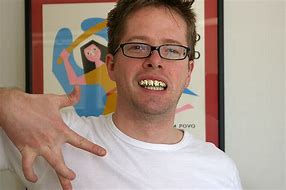 Image result for Grillz Teeth Birmingham