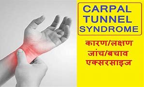 Image result for Carpal Tunnel Syndrome Workers-Compensation