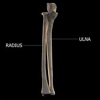 Image result for Radius Ulna Bones