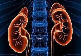 Image result for How Effective Is Dialysis