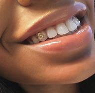 Image result for Dental Jewelry Teeth