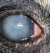 Image result for Red Eye Uveitis