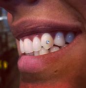 Image result for Dental Jewelry Teeth