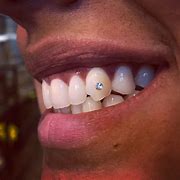 Image result for Dental Jewelry Teeth