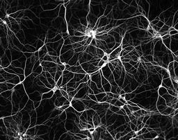 Image result for Red Neuronal Artificial