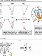 Image result for 12 Lead EKG Strip Phillips