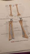 Image result for Anterior View of Radius