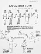 Image result for Radial Nerve Treatment