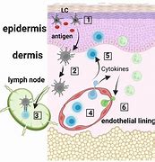 Image result for Island Og Langerhans Cells